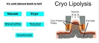 工場価格!!! 機械を細くする新しい Cryolipolysis RF のキャビテーションの真空